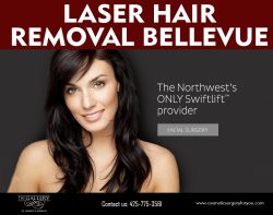 laser hair removal seattle