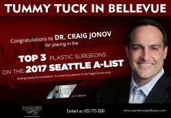 Tummy Tuck in Bellevue , Seattle & kirkland