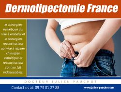dermolipectomie france|http://www.julien-pauchot.com/