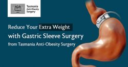 Reduce Your Extra Weight with Gastric Sleeve Surgery from Tasmania Anti-Obesity Surgery