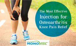 Monovisc – The Most Effective Injection for Osteoarthritis Knee Pain Relief