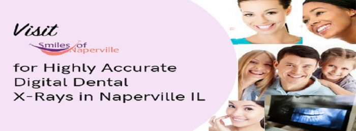Visit Smiles of Naperville for Highly Accurate Digital Dental X-Rays in Naperville IL