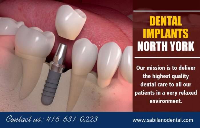 Dental Implants North York | Call – 14166310224 | sabilanodental.com