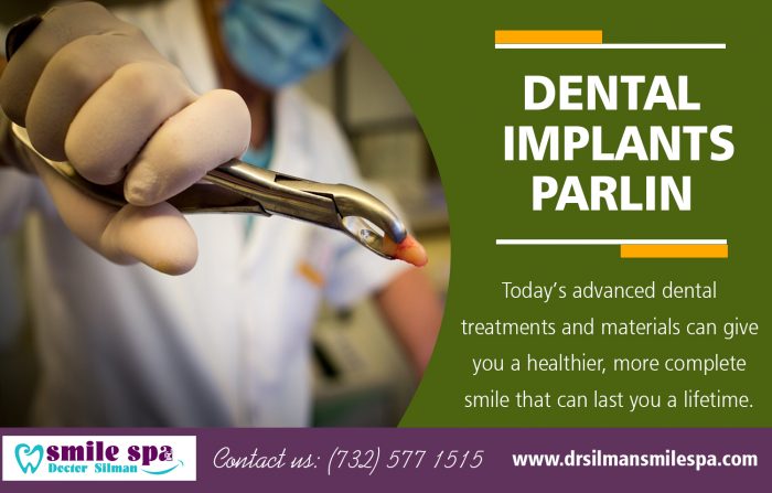 Dental Implants Parlin