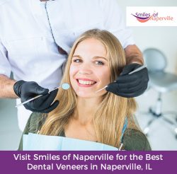 Visit Smiles of Naperville for the Best Dental Veneers in Naperville, IL