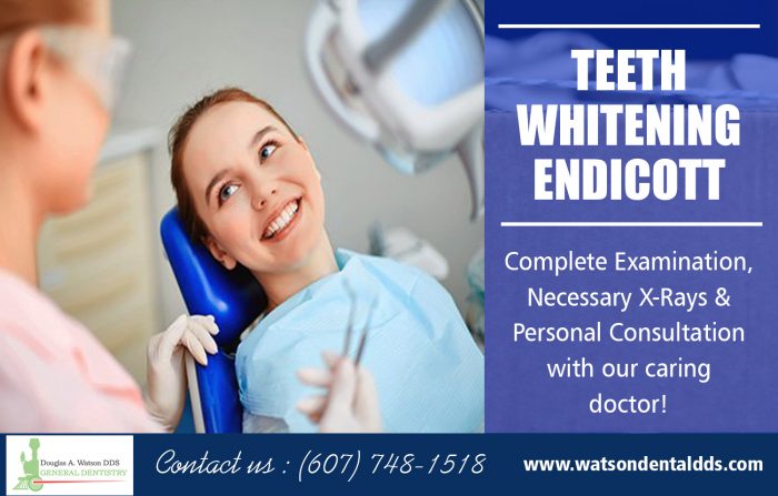 Teeth Whitening Endicott