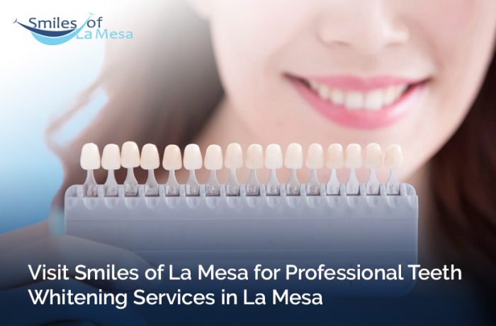 Visit Smiles of La Mesa for Professional Teeth Whitening Services in La Mesa