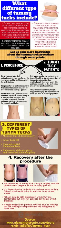 Tummy tucks-Performed by a professional surgeon