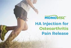 Monovisc – HA Injection for Osteoarthritis Pain Release