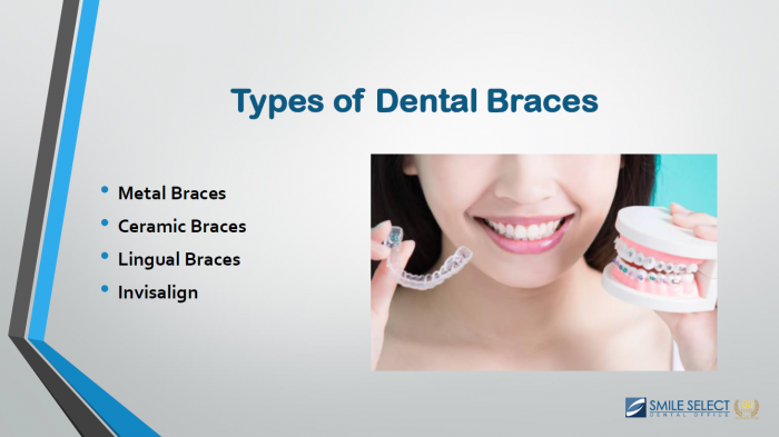 Types of Dental Braces | Smile Select Dental