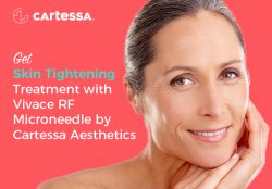 Get Skin Tightening Treatment with Vivace RF Microneedle by Cartessa Aesthetics