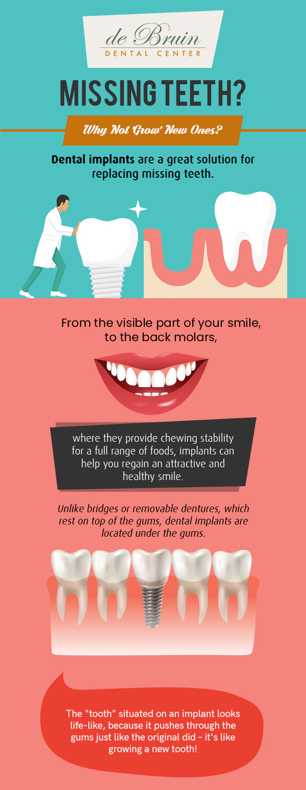 Restore Your Smile with Excellent Implant Dentistry Solutions from de Bruin Dental Center