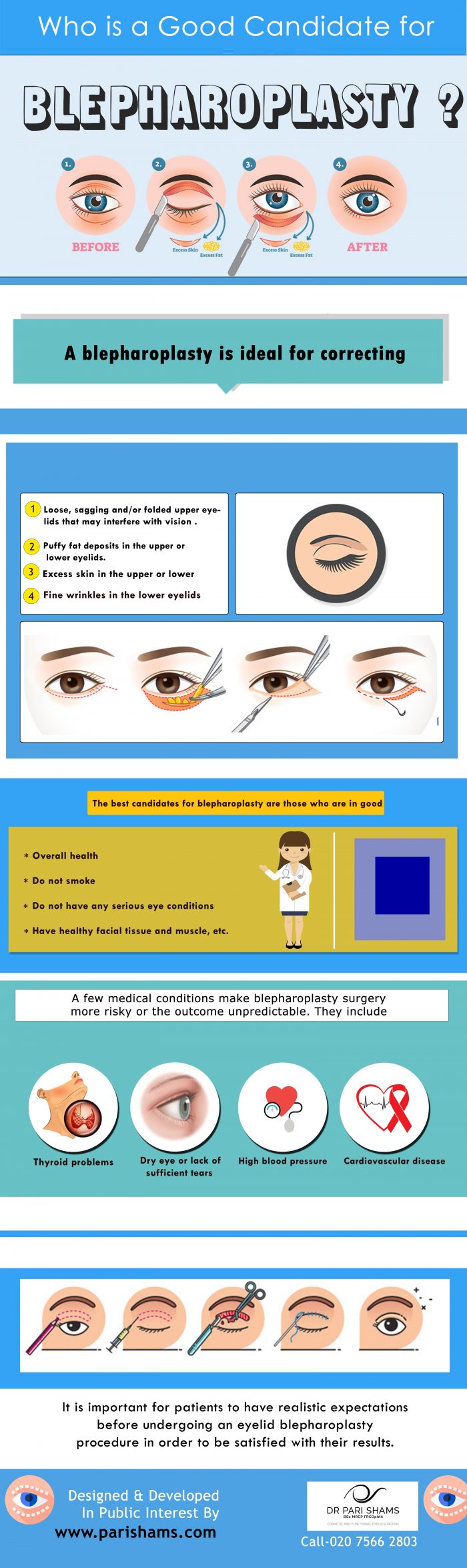 Who is a Good Candidate for Blepharoplasty?