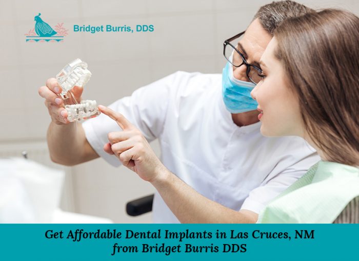 Get Affordable Dental Implants in Las Cruces, NM from Bridget Burris DDS