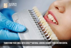 Transform your Smile with CEREC Natural-Looking Crowns from Sheron Dental