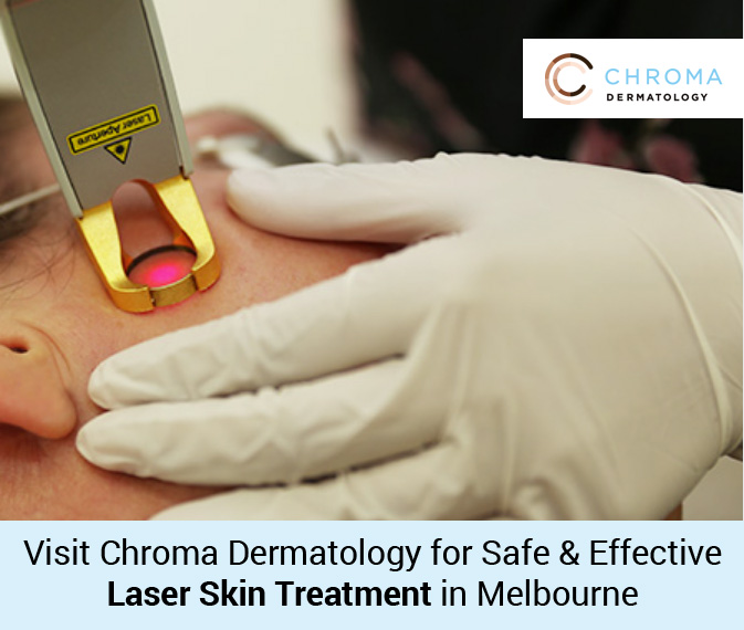 Visit Chroma Dermatology for Safe & Effective Laser Skin Treatment in