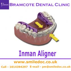 Inman Aligner | Bramcote Dental Clinic