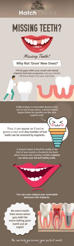 Replace Absent Teeth in Your Mouth with Quality Dental Implants from Hatch Dental