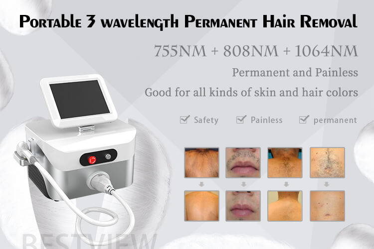 portable 3 wavelength diode laser hair removal machine price
