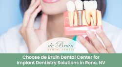 Choose de Bruin Dental Center for Implant Dentistry Solutions in Reno, NV
