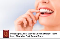 Invisalign: A Fast Way to Obtain Straight Teeth from Chandler Park Dental Care