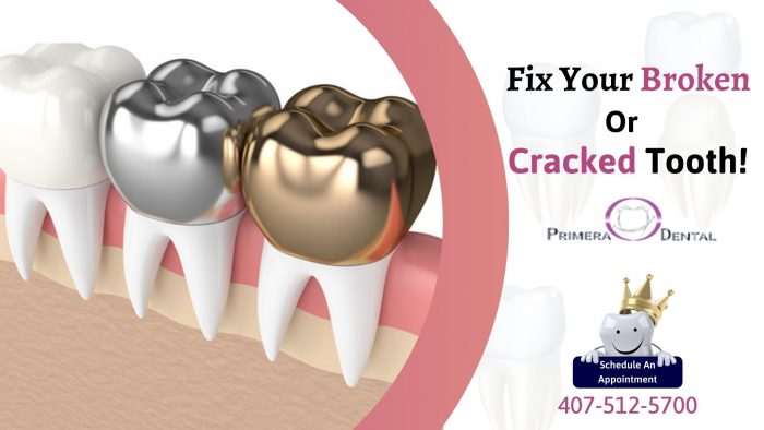 Restore Your Extremely Damaged Teeth With Dental Crown