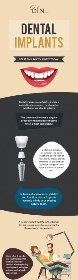 Replace Your Missing Teeth with Dental Implants from Ala Din DDS