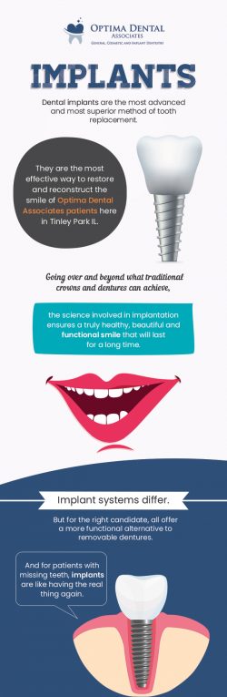 Optima Dental Associates – Restore Your Smile With Dental Implants in Tinley Park, IL