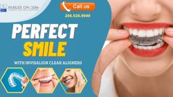 Renovate And Improve Your Smile With Invisalign