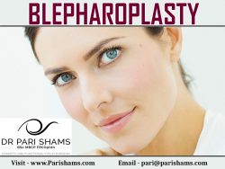 Blepharoplasty By Pari Shams
