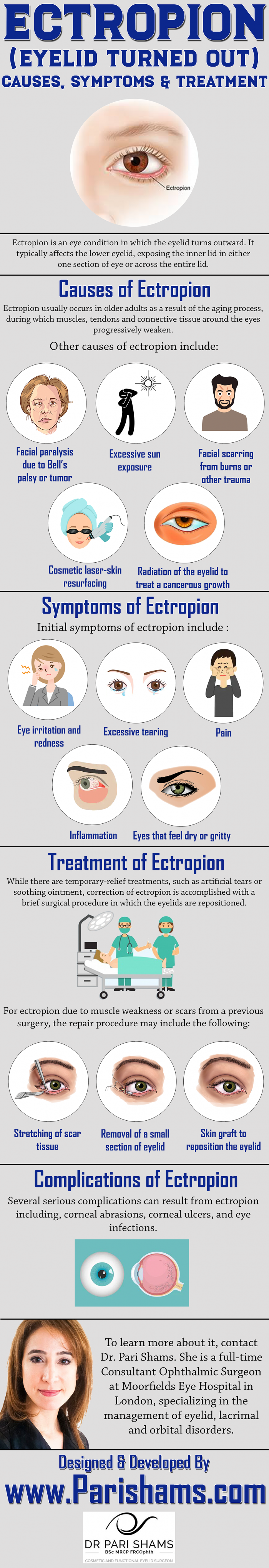 ECTROPION (Eyelid Turned Out) – Causes, Symptoms & Treatment