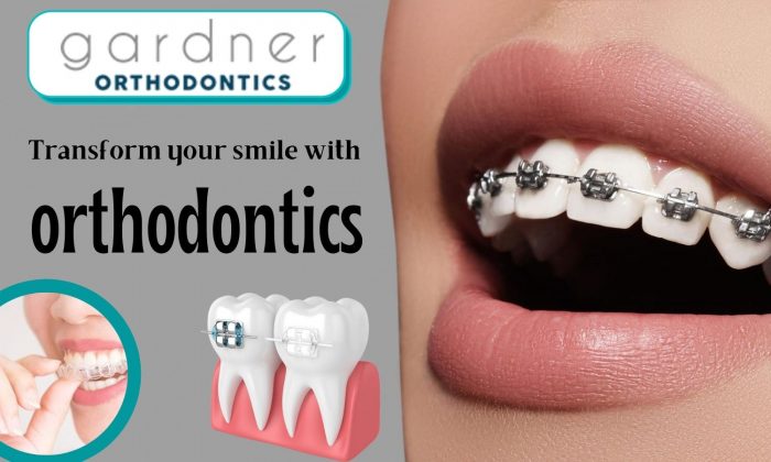 Leading Dental Clinic for Orthodontic Treatment