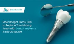 Meet Bridget Burris, DDS to Replace Your Missing Teeth with Dental Implants in Las Cruces, NM