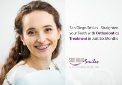 San Diego Smiles – Straighten your Teeth with Orthodontics Treatment in Just Six Months