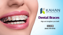 Straighten Your Teeth with Kahan Orthodontics
