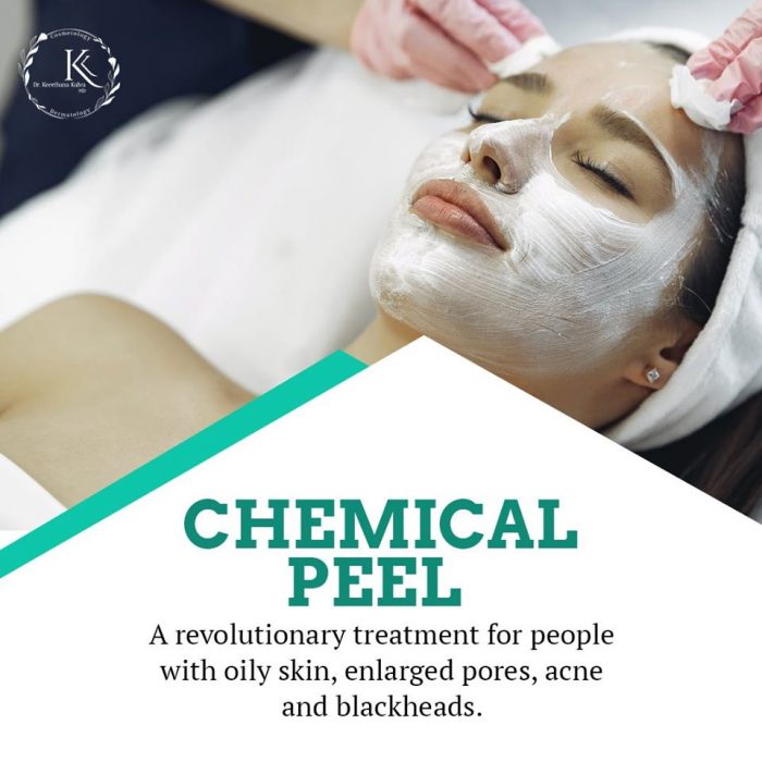 Chemical Peel Treatment in Hyderabad