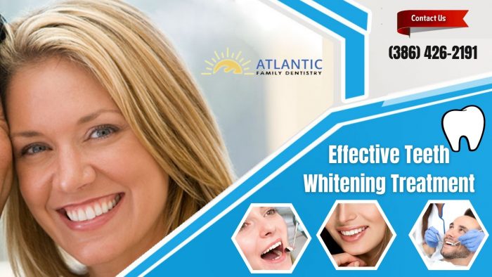 Get A Productive Solution For Stained Teeth