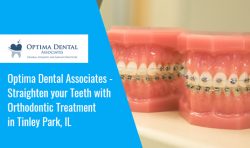 Optima Dental Associates – Straighten your Teeth with Orthodontic Treatment in Tinley Park, IL