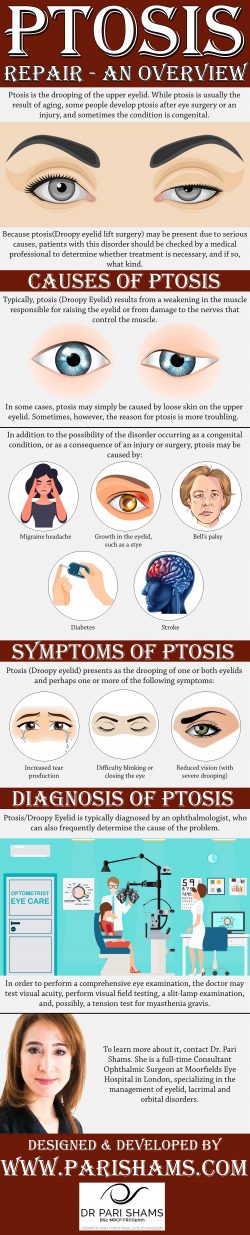 Ptosis Repair – An Overview
