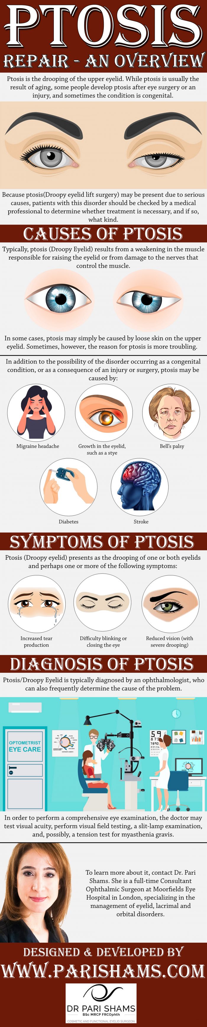 Ptosis Repair – An Overview