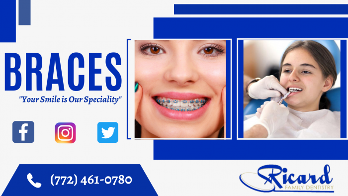 Transform Your Smile with Braces