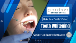 Make Your Teeth Crystal White