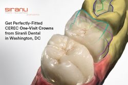 Get Perfectly-Fitted CEREC One-Visit Crowns from Siranli Dental in Washington, DC
