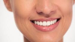 Teeth Bonding Near Me – How Much Does It Cost To Bond A Tooth? – Orthodontist In Houston, TX