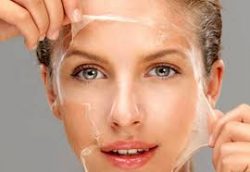 What is Microneedling and what results can I expect at a top Boston Medical Spa?