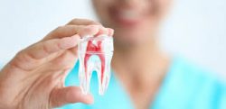 Why Do We Need a Dental Root Canal?