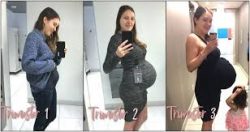 Pregnant With Twins Symptoms