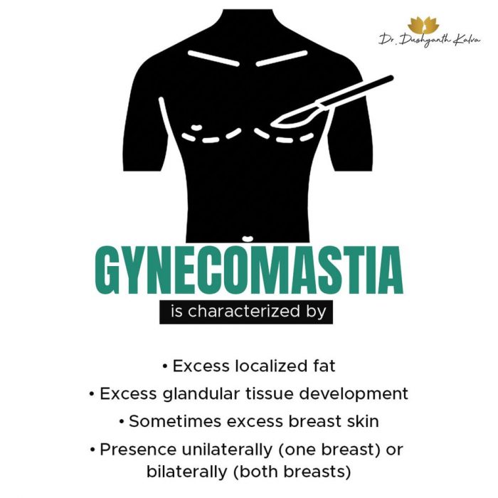 Gynecomastia Treatment in Hyderabad
