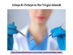 Inlays & Onlays in the Virgin Islands