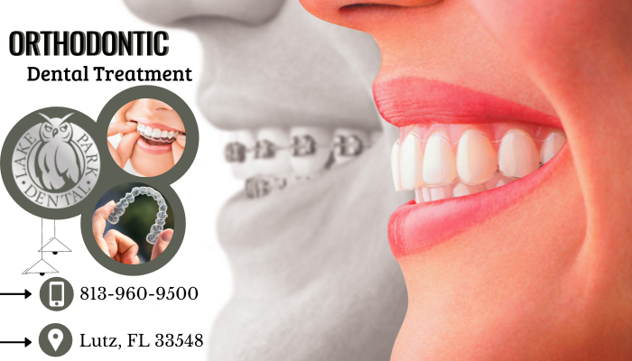 Orthodontic Treatment Can Change Your Appearance